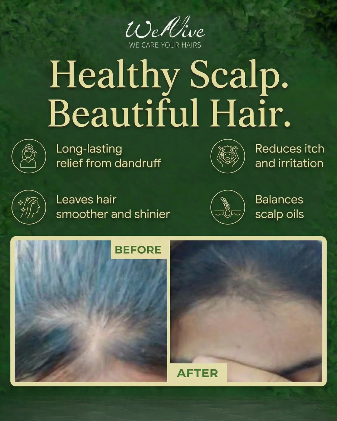 Stop Hair Fall & Regrow Strong, Healthy Hair Naturally