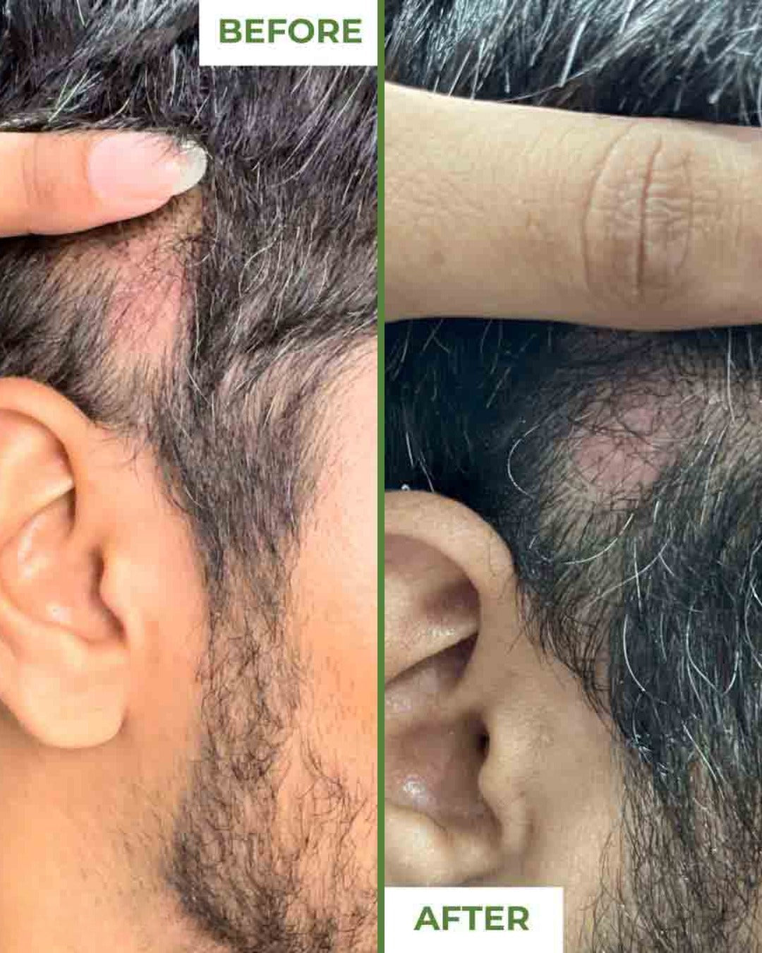 Stop Hair Fall & Regrow Strong, Healthy Hair Naturally
