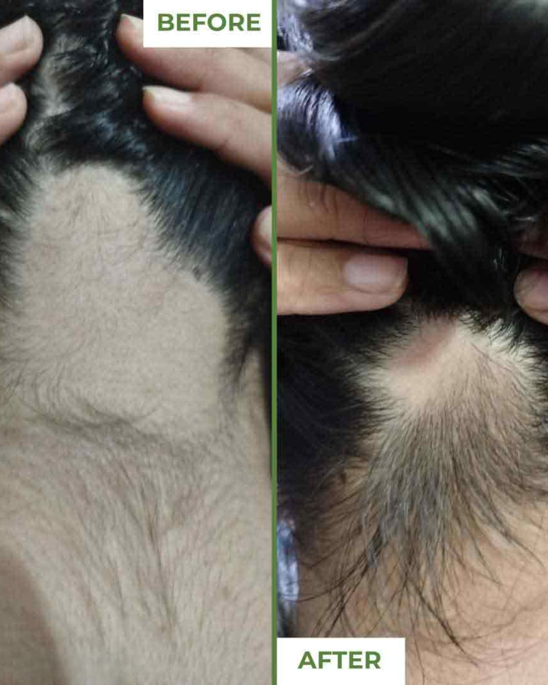 Stop Hair Fall & Regrow Strong, Healthy Hair Naturally