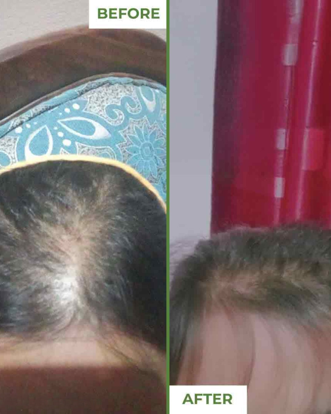 Stop Hair Fall & Regrow Strong, Healthy Hair Naturally